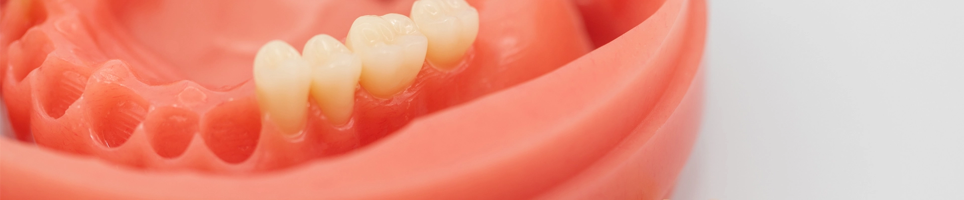 Digital Print Denture Workflow